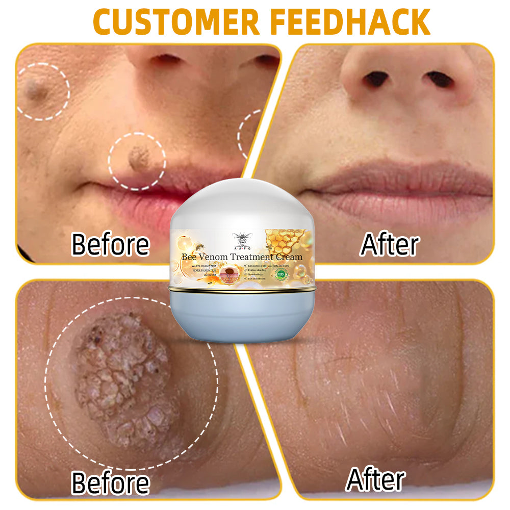 🏵️AAFQ™ Bee Venom Skin Treatment Cream(𝐴𝐴𝐷 𝑅𝑒𝑐𝑜𝑚𝑚𝑒𝑛𝑑𝑒𝑑)