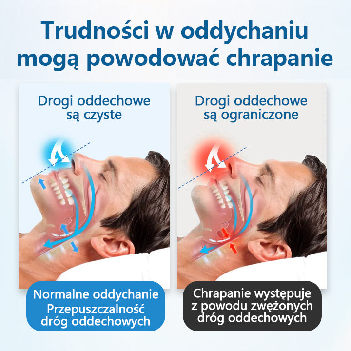➡️ Timilk® Stop Chrapaniu – Nosowy aparat ułatwiający oddychanie i redukujący chrapanie 🌙✨