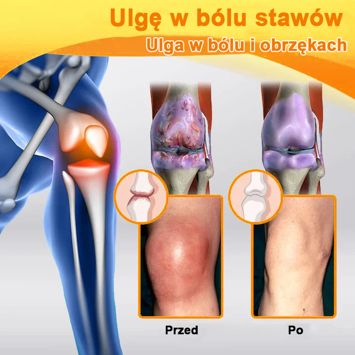 ✅Oficjalny sklep: Ouryard™ Olej magnezowy i miód w sprayu do naprawy stawów👨⚕️Zatwierdzony przez Polską Agencję Leków, Wyrobów Medycznych i Produktów Biologicznych (URPL)