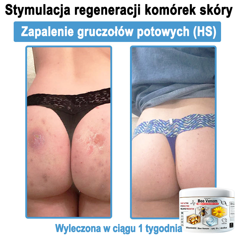 TOD𝐀HOF™🥑 Krem do wielosymptomowej pielęgnacji skóry z jadem pszczelim (Zalecane przez PZH)