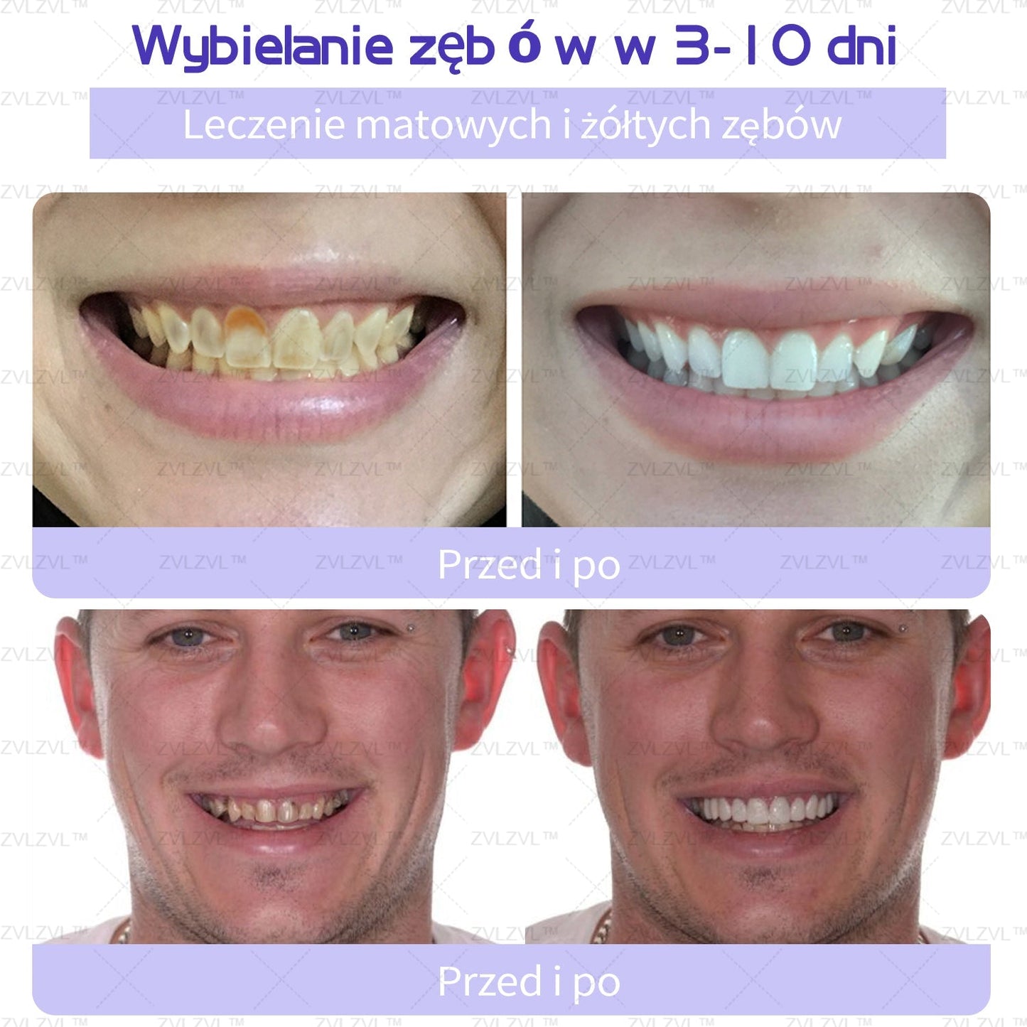 Mineralny proszek do odbudowy zębów ZVLZVL™ 🦷(polecany przez PTS)(👨🏻⚕️Oferta ograniczona czasowo — nie przegap jej👨🏻⚕️)