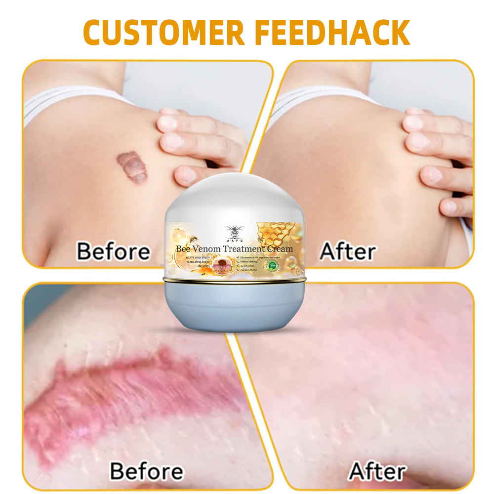 🏵️AAFQ™ Bee Venom Skin Treatment Cream(𝐴𝐴𝐷 𝑅𝑒𝑐𝑜𝑚𝑚𝑒𝑛𝑑𝑒𝑑)