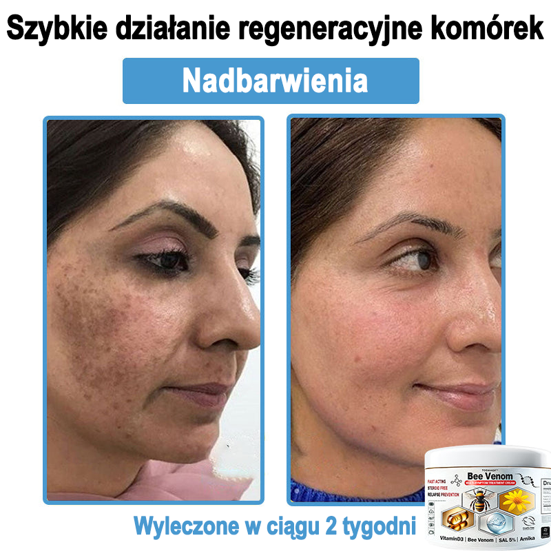 TOD𝐀HOF™🥑 Krem do wielosymptomowej pielęgnacji skóry z jadem pszczelim (Zalecane przez PZH)