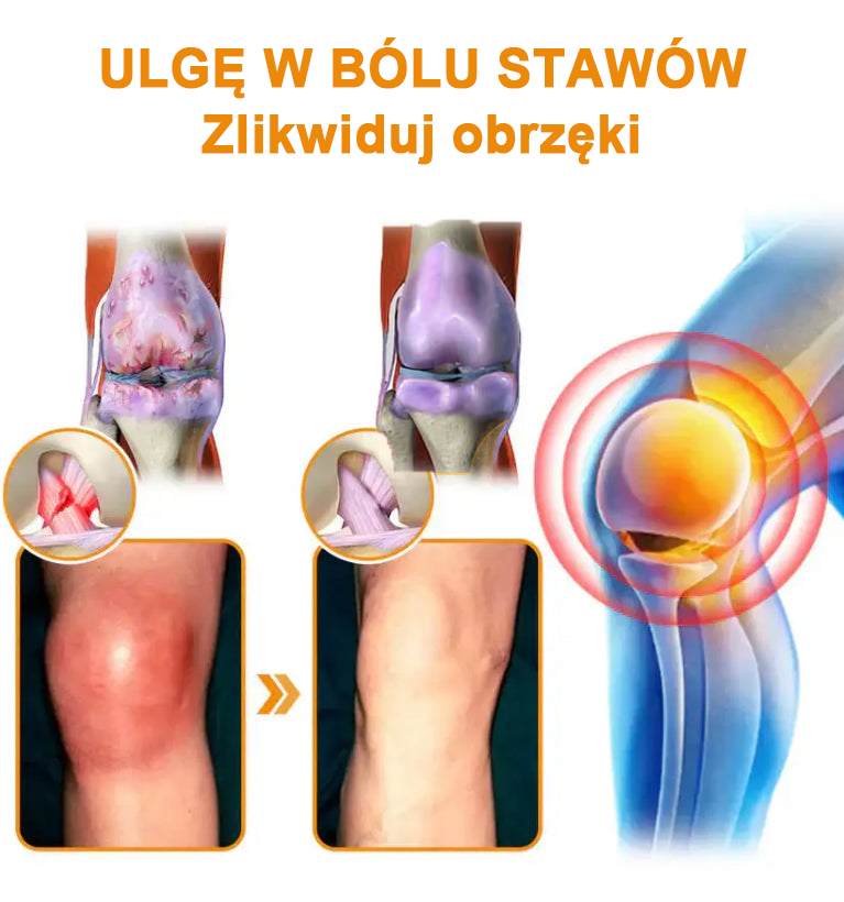 ✅Oficjalny sklep: Ouryard™ Olej magnezowy i miód w sprayu do naprawy stawów👨⚕️Zatwierdzony przez Polską Agencję Leków, Wyrobów Medycznych i Produktów Biologicznych (URPL)