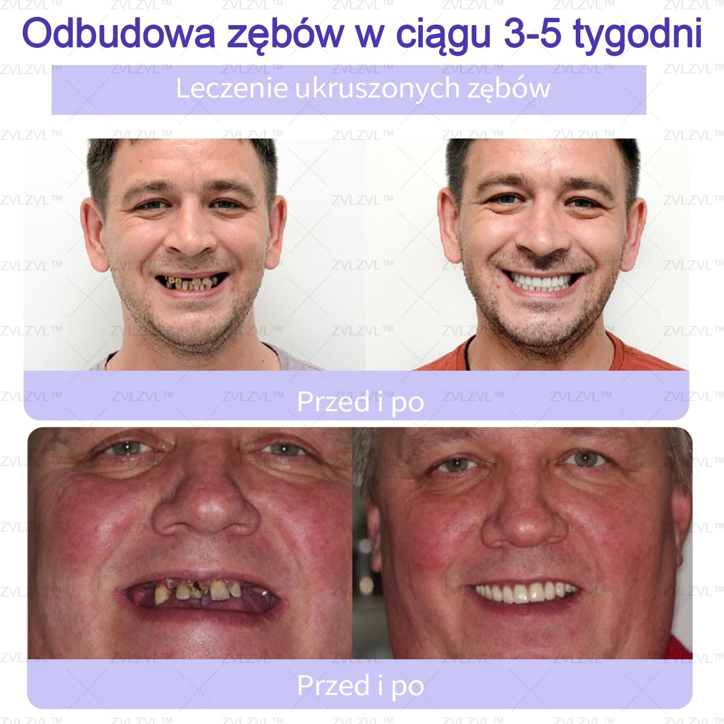 Mineralny proszek do odbudowy zębów ZVLZVL™ 🦷(polecany przez PTS)(👨🏻⚕️Oferta ograniczona czasowo — nie przegap jej👨🏻⚕️)