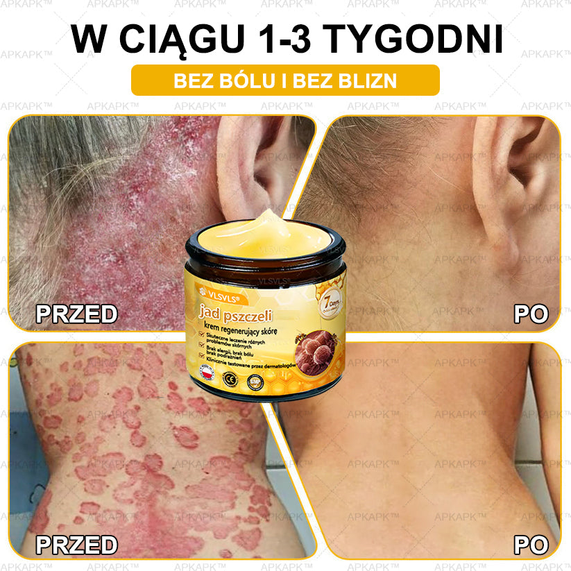 💐🌟💐Wyprodukowano i wysłano z Polski✨ Krem naprawczy do skóry VLSVLS® z jadem pszczelim🔥 Ostatni dzień zniżki 80%