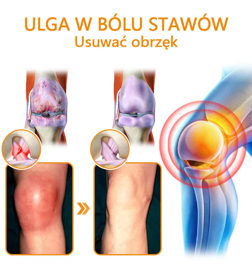✅Oficjalny sklep: flysmus™ Lidocaine Szybko działający środek przeciwbólowy i leczniczy 👨⚕️Zatwierdzony przez Polskie Towarzystwo Ortopedyczne (PTG) (łagodzi ból stawów, obrzęki, sztywność, zaczerwienienia, ciepło, bolesność i zmęczenie stawów)