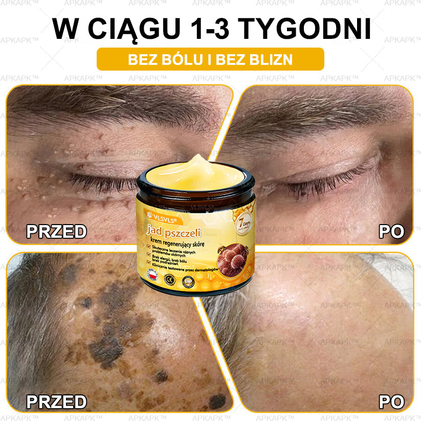 💐🌟💐Wyprodukowano i wysłano z Polski✨ Krem naprawczy do skóry VLSVLS® z jadem pszczelim🔥 Ostatni dzień zniżki 80%