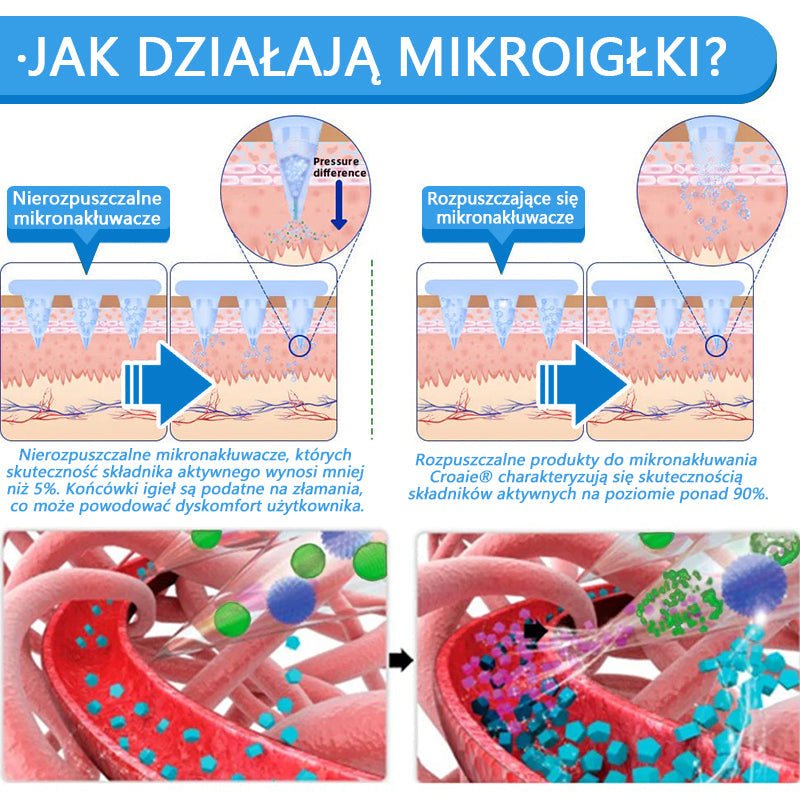 🔥[Zobacz wyniki w ciągu 7 dni 🛡Croaie® SMGT-GLP-1 Nano Microneedle Patch (Bezbolesny, długotrwały, zajmujący się cukrzycą, otyłością i chorobami układu krążenia).