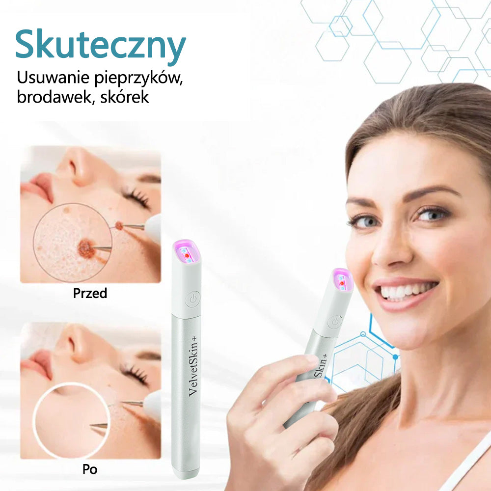 ✨ Bikenda® – Laserowy Długopis CO₂ do Usuwania 🟤 Znamion, 🦠 Brodawek, 🔘 Przebarwień i Innych Niedoskonałości Skóry
