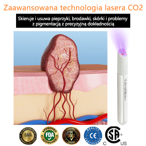 ✨ Bikenda® – Laserowy Długopis CO₂ do Usuwania 🟤 Znamion, 🦠 Brodawek, 🔘 Przebarwień i Innych Niedoskonałości Skóry