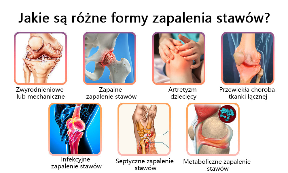 ✅Oficjalny sklep: flysmus™ Lidocaine Szybko działający środek przeciwbólowy i leczniczy 👨⚕️Zatwierdzony przez Polskie Towarzystwo Ortopedyczne (PTG) (łagodzi ból stawów, obrzęki, sztywność, zaczerwienienia, ciepło, bolesność i zmęczenie stawów)