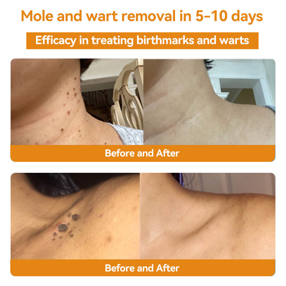 π΅οΈππ’ππππ’β’ Bee Venom Skin Treatment CreamοΌπ΄π΄π· π
πππππππππποΌ