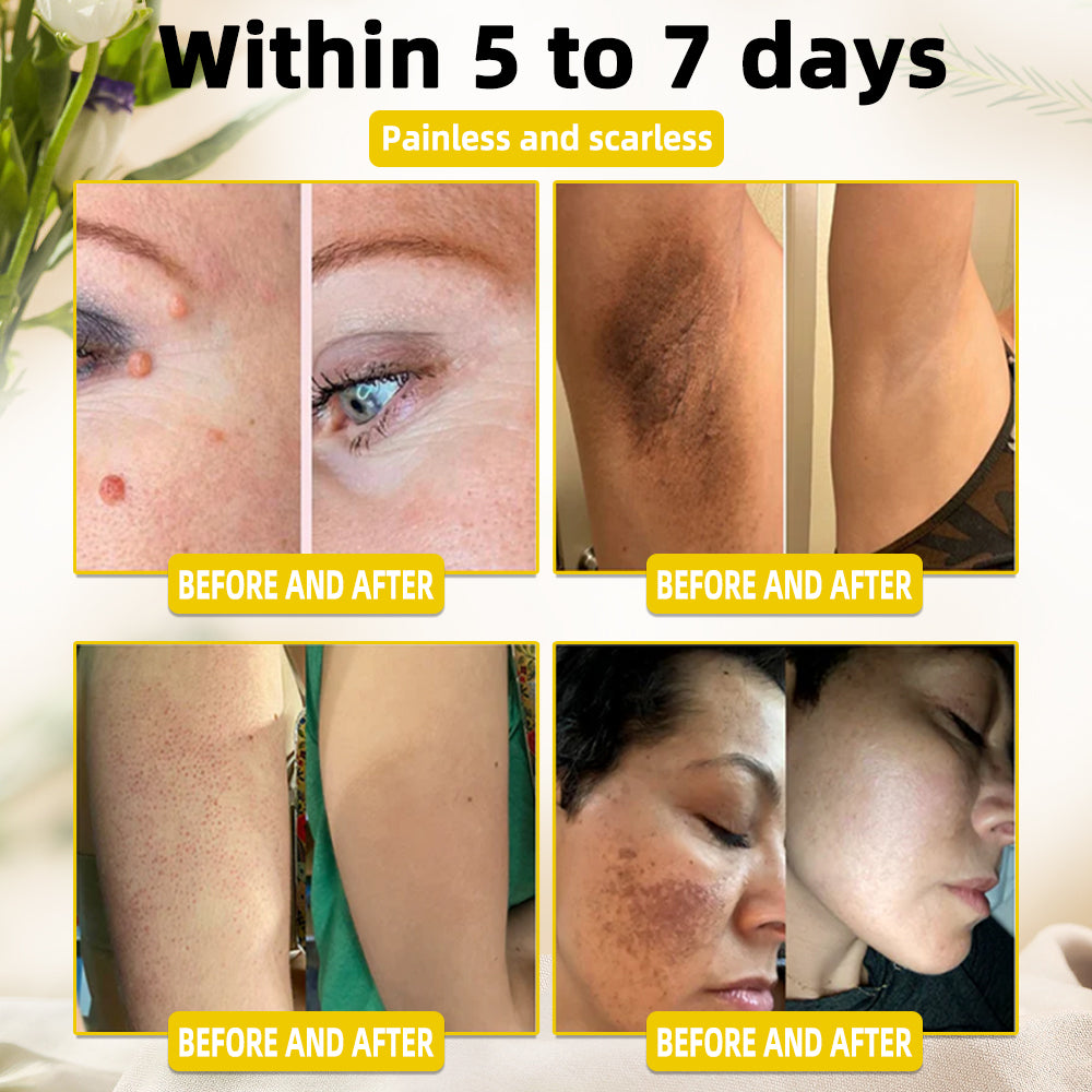 🏵️AAFQ™ Bee Venom Skin Treatment Cream(𝐴𝐴𝐷 𝑅𝑒𝑐𝑜𝑚𝑚𝑒𝑛𝑑𝑒𝑑)