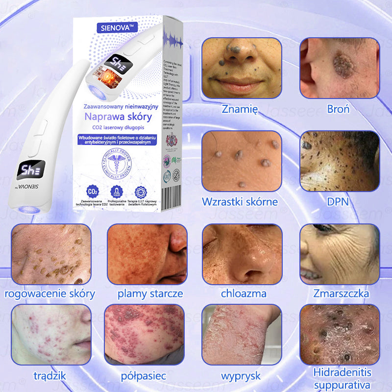SIE𝖭𝖮𝖵𝖠™ Zaawansowany nieinwazyjny laser CO₂ do naprawy skóry 🎉 (Delikatnie usuwa brodawki, znamiona, plamy starcze i narośla skórne – bez bólu, bez zamieszania!)