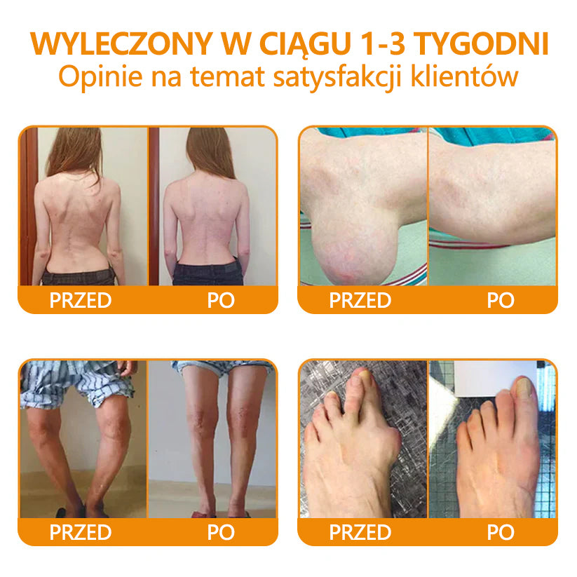✅Oficjalny sklep: flysmus™ Lidocaine Szybko działający środek przeciwbólowy i leczniczy 👨⚕️Zatwierdzony przez Polskie Towarzystwo Ortopedyczne (PTG) (łagodzi ból stawów, obrzęki, sztywność, zaczerwienienia, ciepło, bolesność i zmęczenie stawów)