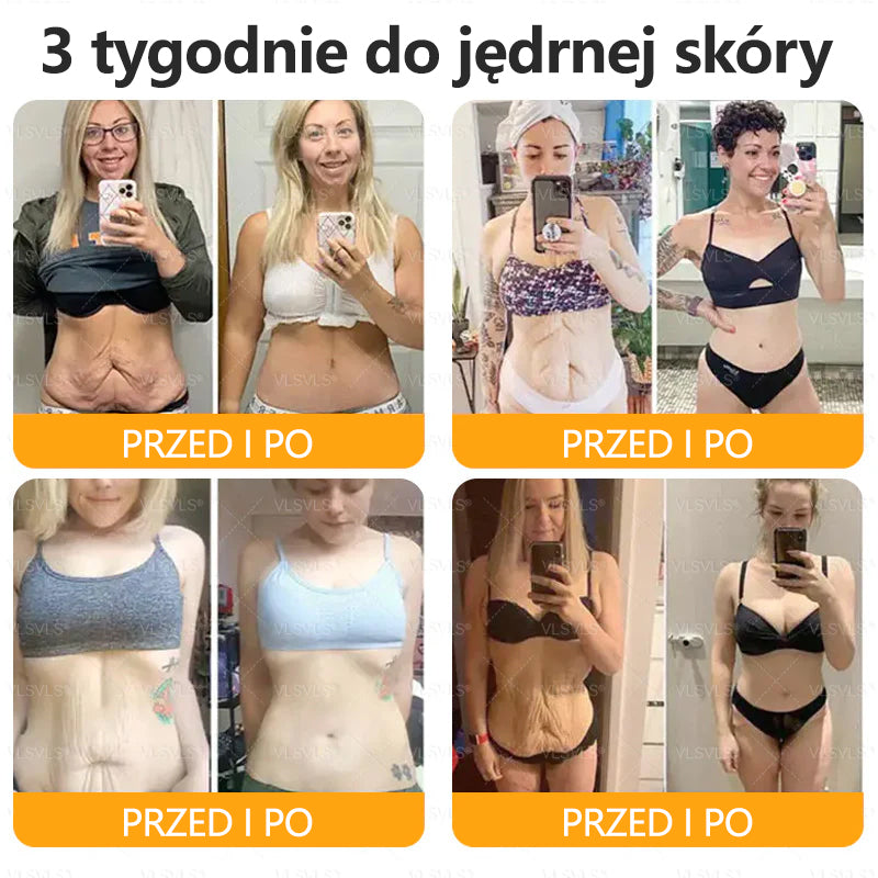 💐🌟💐Wyprodukowano i wysłano z Polski✨ Krem naprawczy do skóry VLSVLS® z jadem pszczelim🔥 Ostatni dzień zniżki 80%