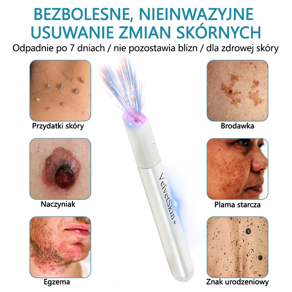 ✨ Bikenda® – Laserowy Długopis CO₂ do Usuwania 🟤 Znamion, 🦠 Brodawek, 🔘 Przebarwień i Innych Niedoskonałości Skóry
