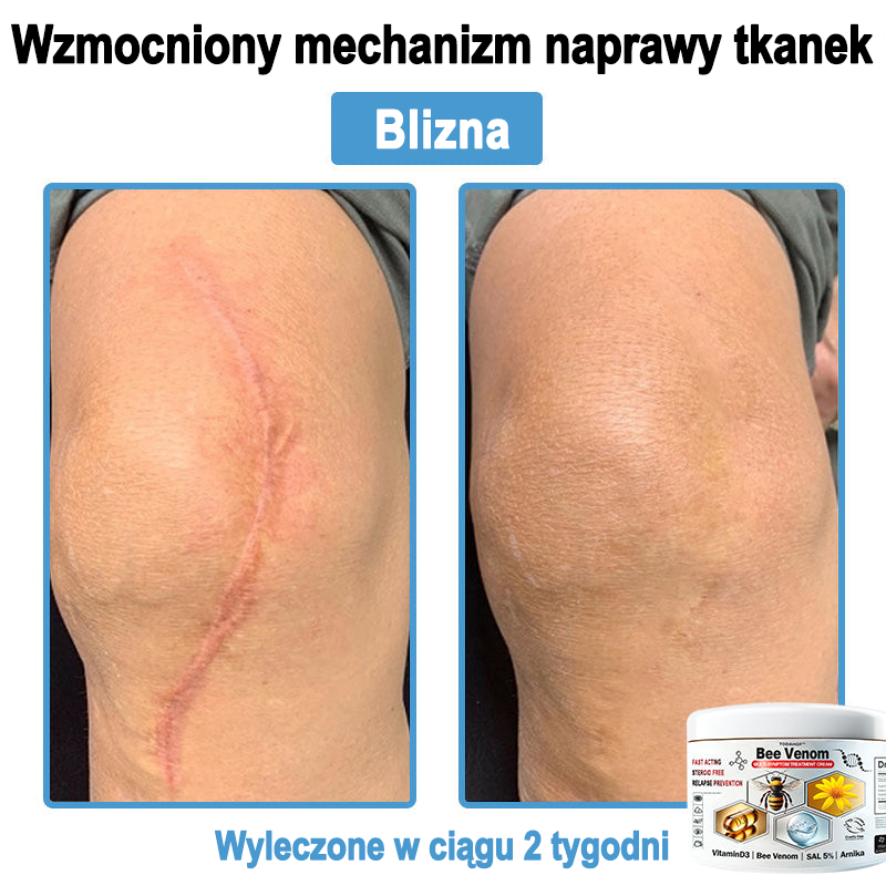 TOD𝐀HOF™🥑 Krem do wielosymptomowej pielęgnacji skóry z jadem pszczelim (Zalecane przez PZH)