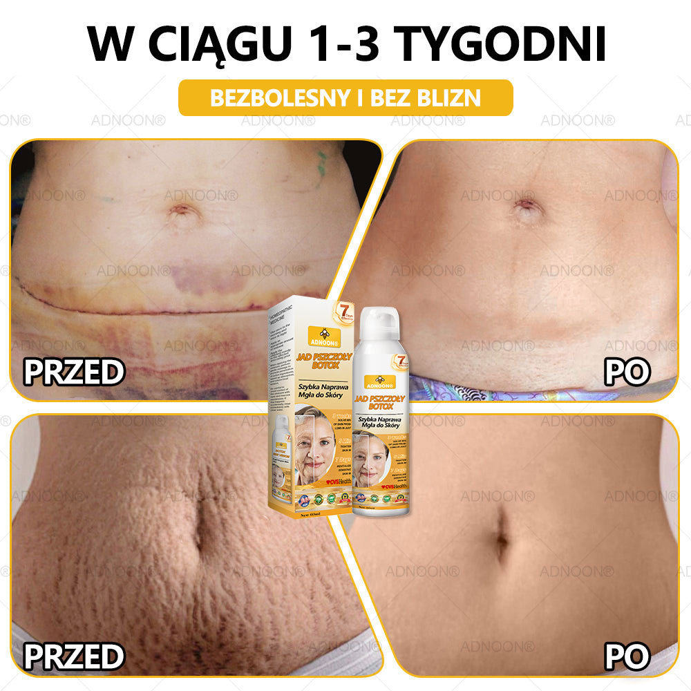 Oficjalny sklep✅: ADNOON® Botox Skin Care Spray, przeciwstarzeniowy, nawilżający, naprawczy, wyrównujący koloryt skóry, leczący trądzik i przebarwienia, usuwający brodawki i znamiona, łagodzący łuszczycę (certyfikowany przez GIS)✨