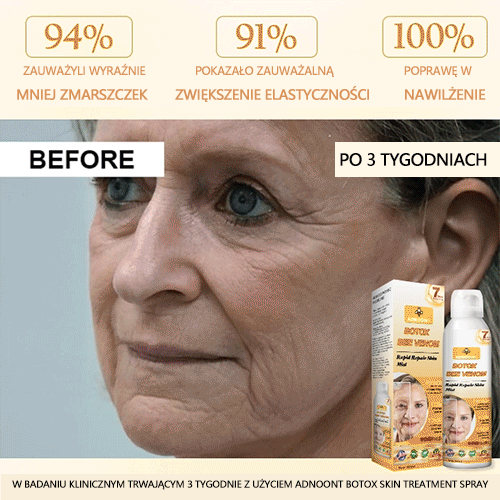 Oficjalny sklep✅: ADNOON® Botox Skin Care Spray, przeciwstarzeniowy, nawilżający, naprawczy, wyrównujący koloryt skóry, leczący trądzik i przebarwienia, usuwający brodawki i znamiona, łagodzący łuszczycę (certyfikowany przez GIS)✨