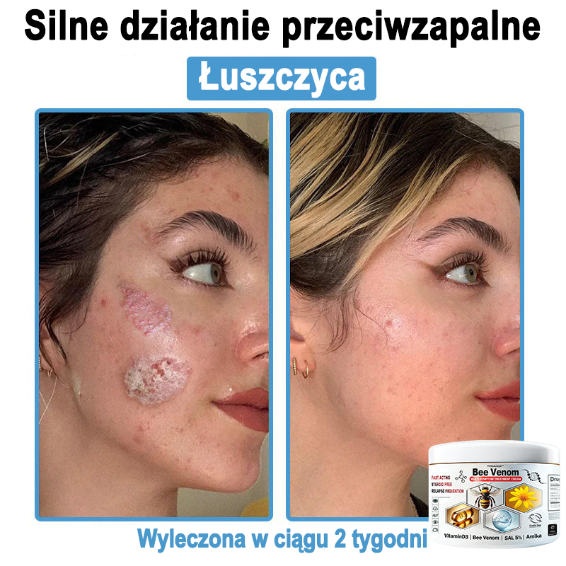 TOD𝐀HOF™🥑 Krem do wielosymptomowej pielęgnacji skóry z jadem pszczelim (Zalecane przez PZH)