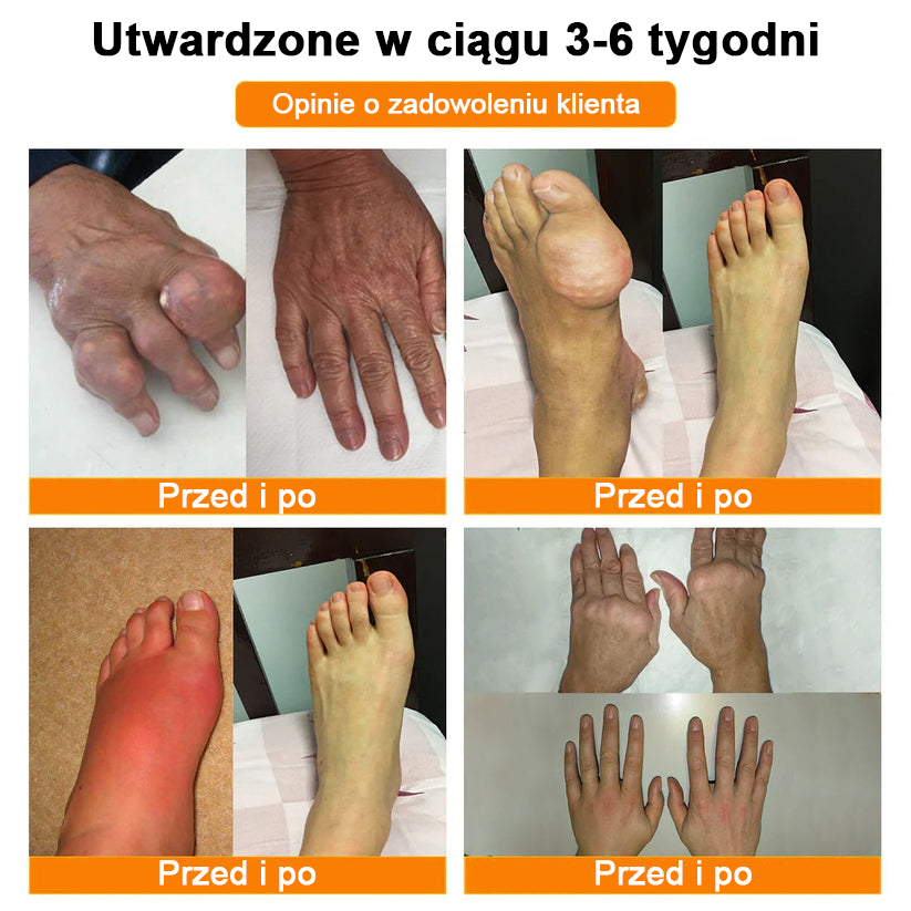 ✅Oficjalny sklep: Ouryard™ Olej magnezowy i miód w sprayu do naprawy stawów👨⚕️Zatwierdzony przez Polską Agencję Leków, Wyrobów Medycznych i Produktów Biologicznych (URPL)