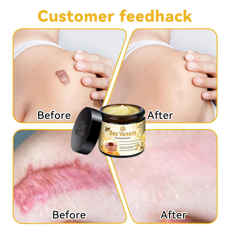 π΅οΈππ’ππππ’β’ Bee Venom Skin Treatment CreamοΌπ΄π΄π· π
πππππππππποΌ