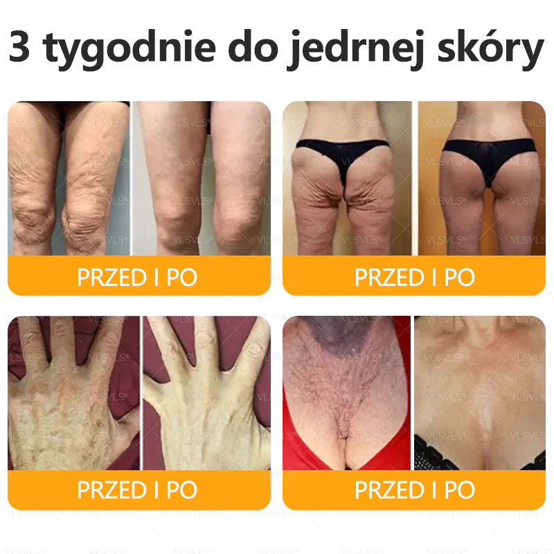 💐🌟💐Wyprodukowano i wysłano z Polski✨ Krem naprawczy do skóry VLSVLS® z jadem pszczelim🔥 Ostatni dzień zniżki 80%