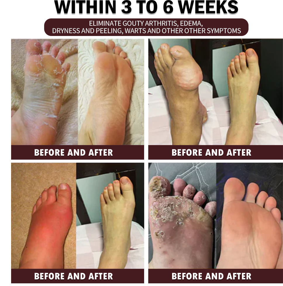 30-Herb Slimming & Detox Foot Bath Medicinal Drops❤️👩⚕️