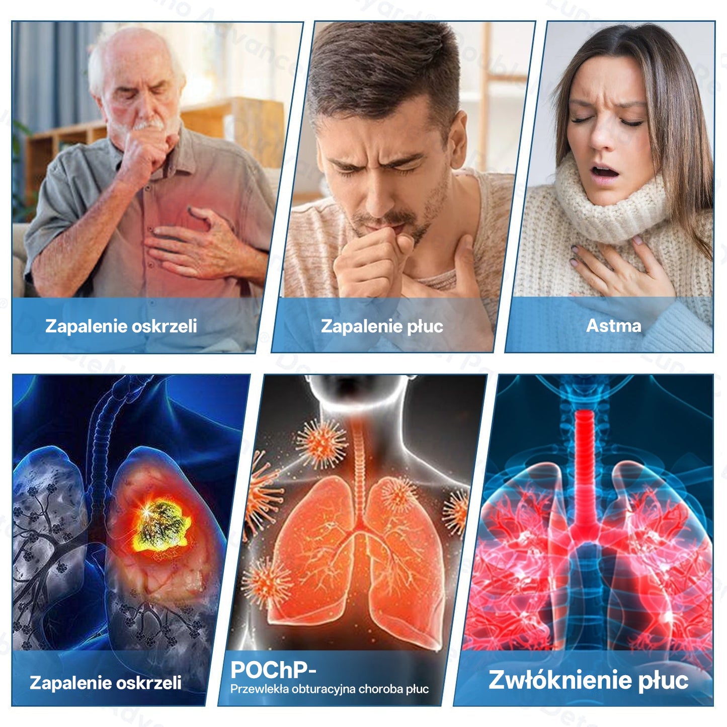✅🫁 Zvoevo® Podwójne Nano – Plastry na ulgę przy POChP 💝 (kaszel, świszczący oddech, duszność, flegma, zatkany nos, zapalenie oskrzeli, alergie, dyskomfort płuc)