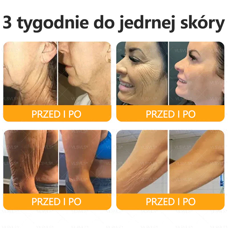 💐🌟💐Wyprodukowano i wysłano z Polski✨ Krem naprawczy do skóry VLSVLS® z jadem pszczelim🔥 Ostatni dzień zniżki 80%
