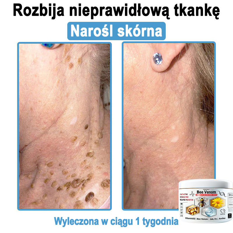 TOD𝐀HOF™🥑 Krem do wielosymptomowej pielęgnacji skóry z jadem pszczelim (Zalecane przez PZH)