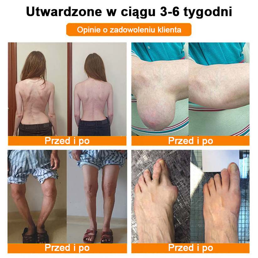 ✅Oficjalny sklep: Ouryard™ Olej magnezowy i miód w sprayu do naprawy stawów👨⚕️Zatwierdzony przez Polską Agencję Leków, Wyrobów Medycznych i Produktów Biologicznych (URPL)