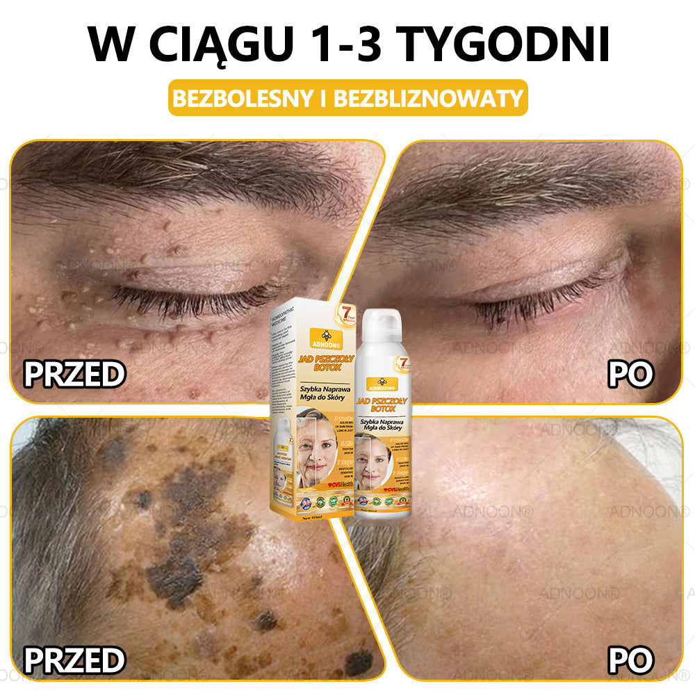Oficjalny sklep✅: ADNOON® Botox Skin Care Spray, przeciwstarzeniowy, nawilżający, naprawczy, wyrównujący koloryt skóry, leczący trądzik i przebarwienia, usuwający brodawki i znamiona, łagodzący łuszczycę (certyfikowany przez GIS)✨