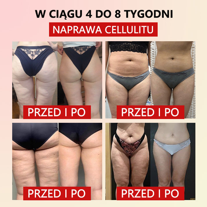 Flouris™ Mikro-wibracyjny Pas Wzmacniający Zioło Piołun do Kształtowania Ciała❤️ (Zalecane przez chirurgów plastycznych)