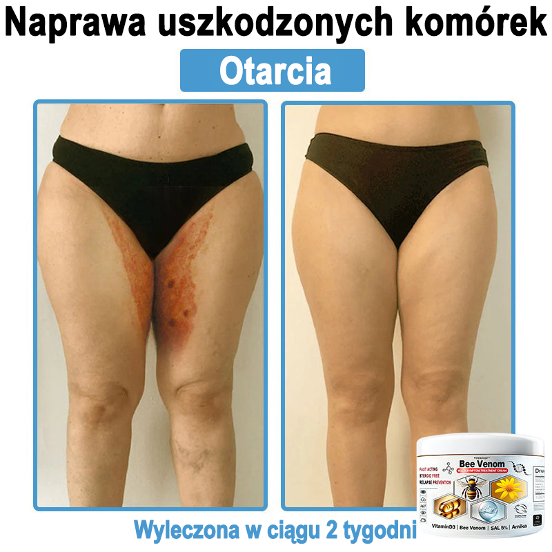 TOD𝐀HOF™🥑 Krem do wielosymptomowej pielęgnacji skóry z jadem pszczelim (Zalecane przez PZH)