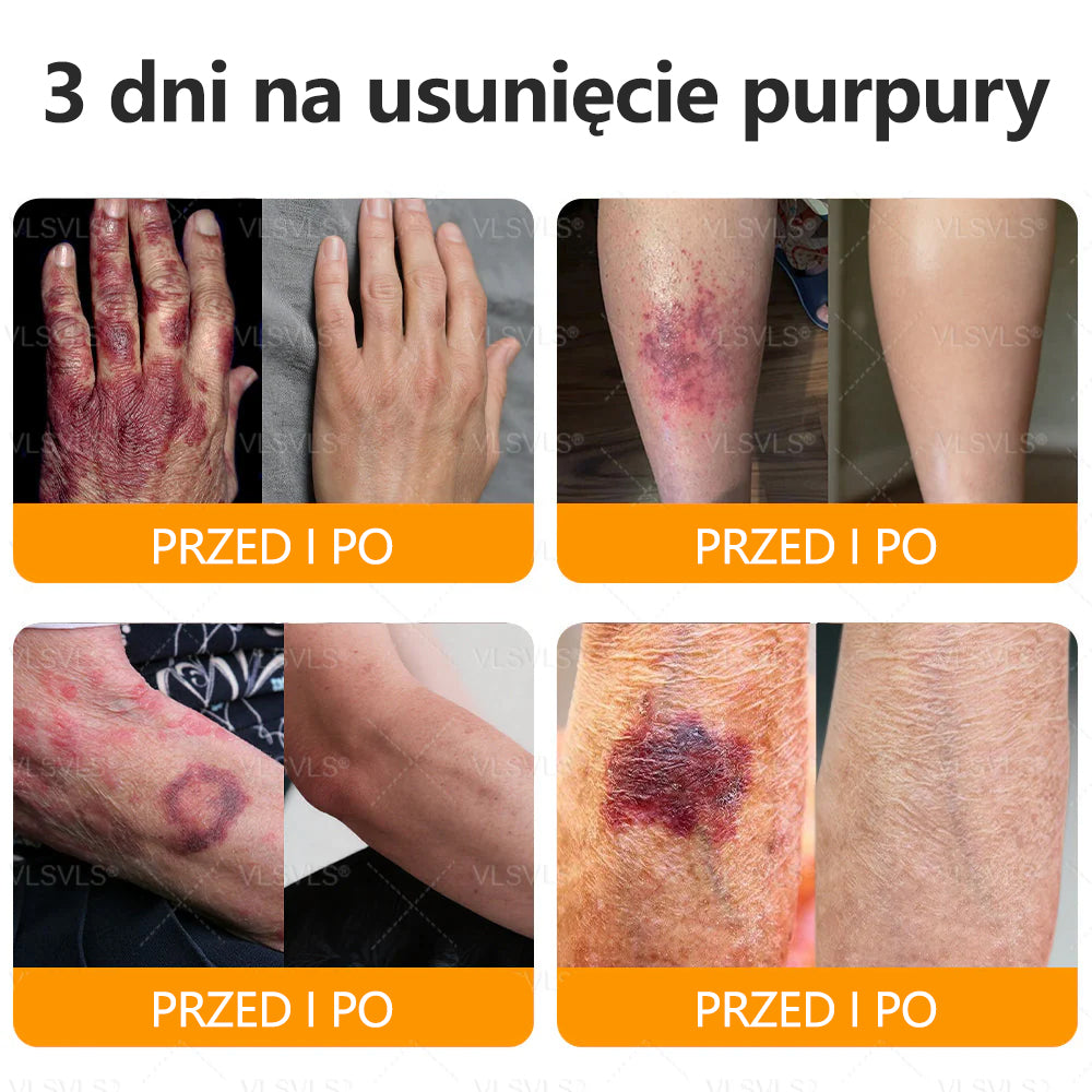💐🌟💐Wyprodukowano i wysłano z Polski✨ Krem naprawczy do skóry VLSVLS® z jadem pszczelim🔥 Ostatni dzień zniżki 80%
