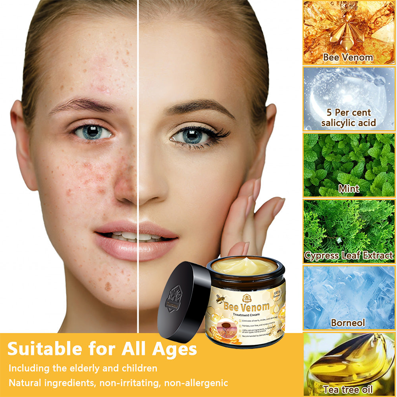 π΅οΈππ’ππππ’β’ Bee Venom Skin Treatment CreamοΌπ΄π΄π· π
πππππππππποΌ