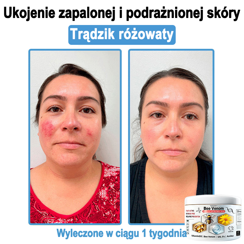 TOD𝐀HOF™🥑 Krem do wielosymptomowej pielęgnacji skóry z jadem pszczelim (Zalecane przez PZH)