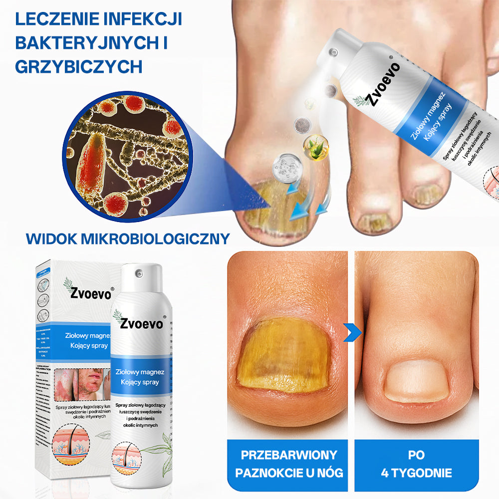 ✅ Oficjalny Sklep: Zvoevo® Magnezowy Ziołowy Spray na Łuszczycę ⚕️ Certyfikowany przez FDA (Łagodzi łuszczycę i egzemę, poprawia infekcje bakteryjne w okolicach intymnych, leczy trądzik i brodawki, łagodzi ból stawów i ból neuropatyczny)