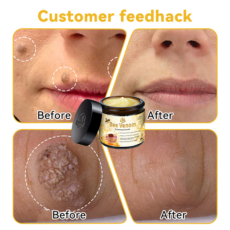 π΅οΈππ’ππππ’β’ Bee Venom Skin Treatment CreamοΌπ΄π΄π· π
πππππππππποΌ