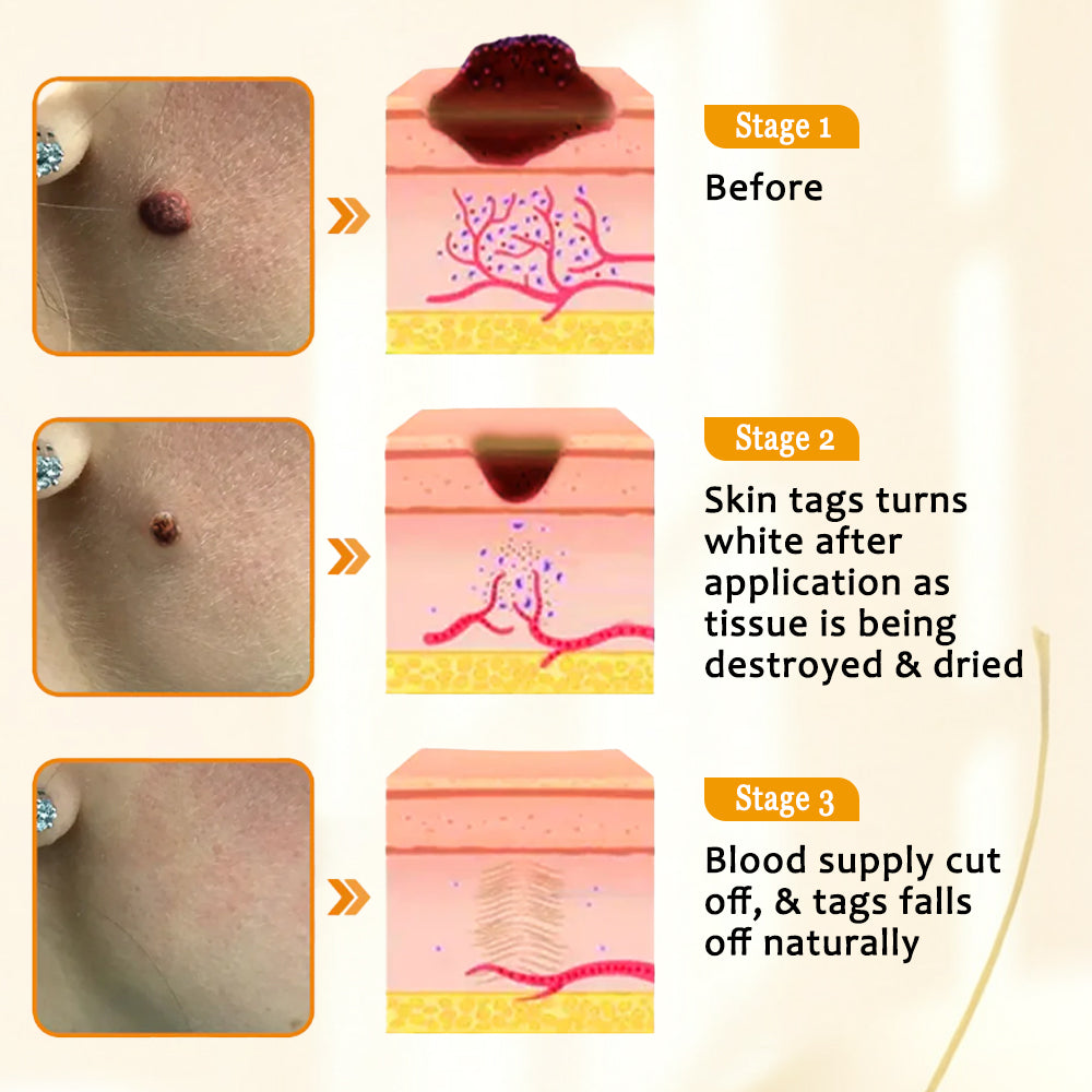 🏵️AAFQ™ Bee Venom Skin Treatment Cream(𝐴𝐴𝐷 𝑅𝑒𝑐𝑜𝑚𝑚𝑒𝑛𝑑𝑒𝑑)