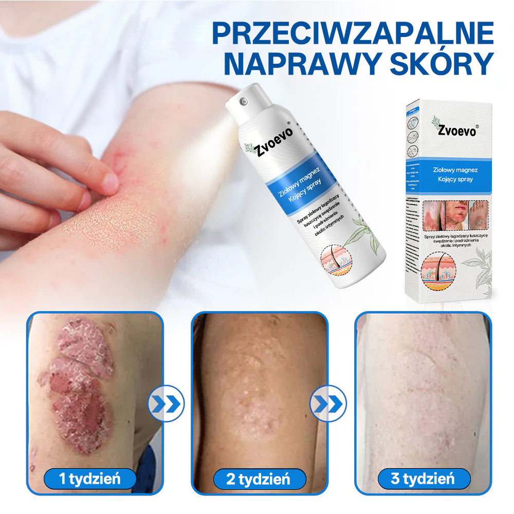 ✅ Oficjalny Sklep: Zvoevo® Magnezowy Ziołowy Spray na Łuszczycę ⚕️ Certyfikowany przez FDA (Łagodzi łuszczycę i egzemę, poprawia infekcje bakteryjne w okolicach intymnych, leczy trądzik i brodawki, łagodzi ból stawów i ból neuropatyczny)