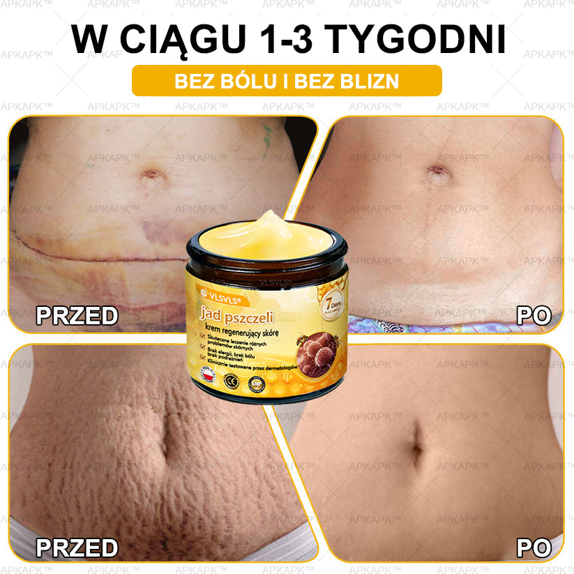 💐🌟💐Wyprodukowano i wysłano z Polski✨ Krem naprawczy do skóry VLSVLS® z jadem pszczelim🔥 Ostatni dzień zniżki 80%