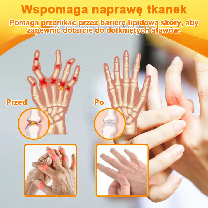 ✅Oficjalny sklep: Ouryard™ Olej magnezowy i miód w sprayu do naprawy stawów👨⚕️Zatwierdzony przez Polską Agencję Leków, Wyrobów Medycznych i Produktów Biologicznych (URPL)