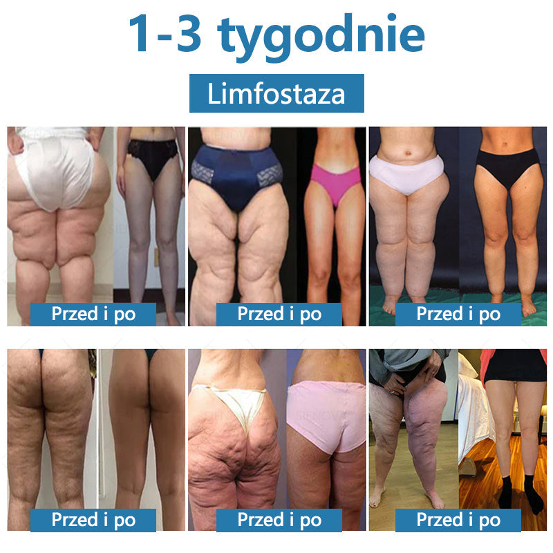 SIE𝖭𝖮𝖵𝖠™💎 Przenośne urządzenie do drenażu limfatycznego i relaksacji stawów👨⚕️Oryginalna terapia 2 w 1 | URPL✅ Polecane