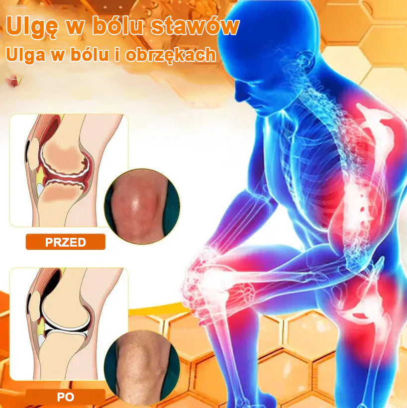 ✅Oficjalny sklep: Ouryard™ Olej magnezowy i miód w sprayu do naprawy stawów👨⚕️Zatwierdzony przez Polską Agencję Leków, Wyrobów Medycznych i Produktów Biologicznych (URPL)