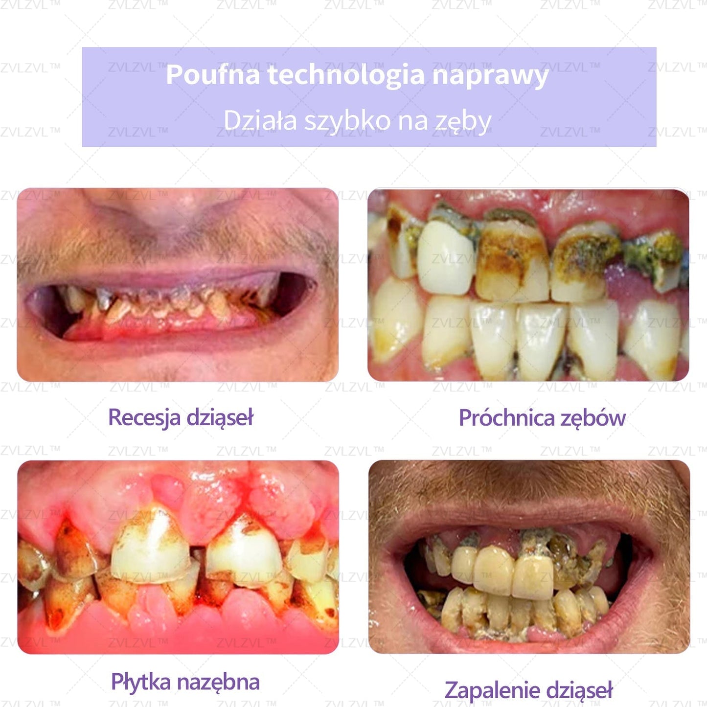 Mineralny proszek do odbudowy zębów ZVLZVL™ 🦷(polecany przez PTS)(👨🏻⚕️Oferta ograniczona czasowo — nie przegap jej👨🏻⚕️)