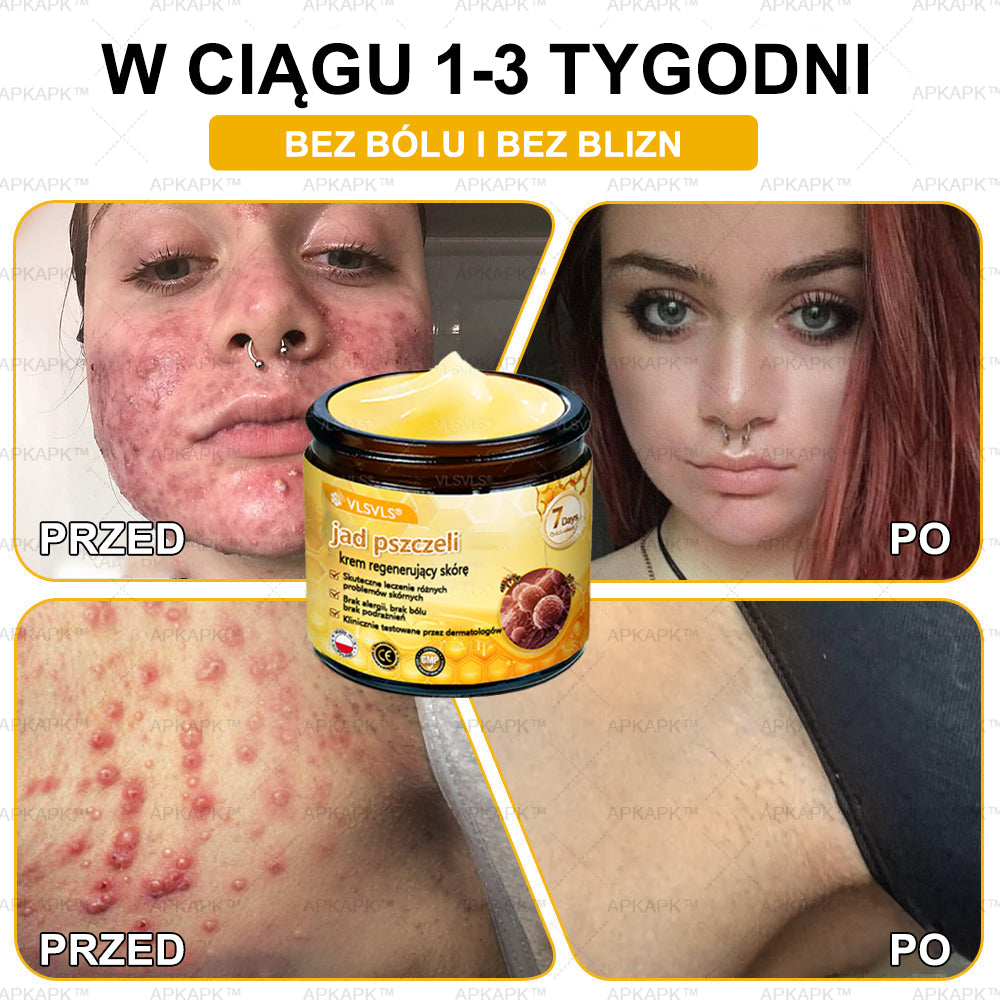 💐🌟💐Wyprodukowano i wysłano z Polski✨ Krem naprawczy do skóry VLSVLS® z jadem pszczelim🔥 Ostatni dzień zniżki 80%